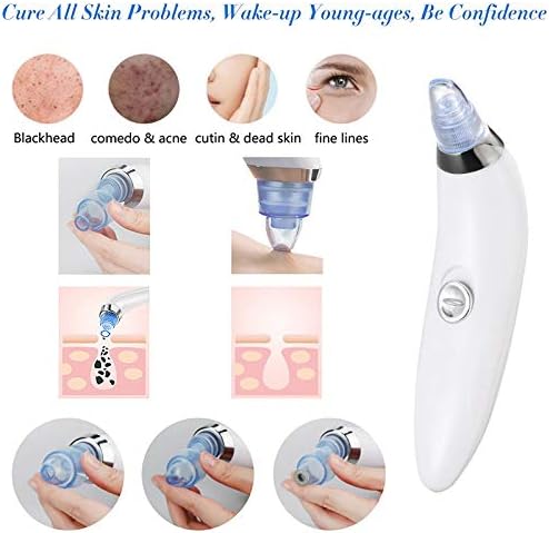 4-in-1 Pore Vacuum