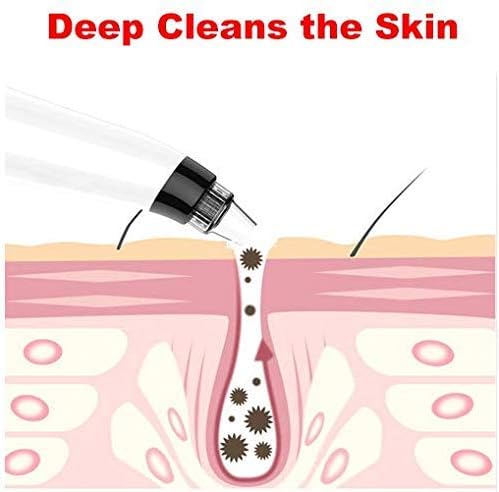 4-in-1 Pore Vacuum