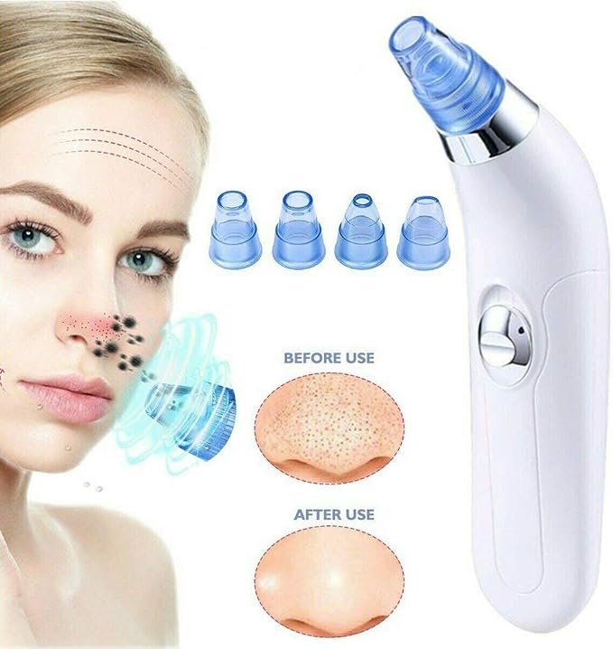 4-in-1 Pore Vacuum