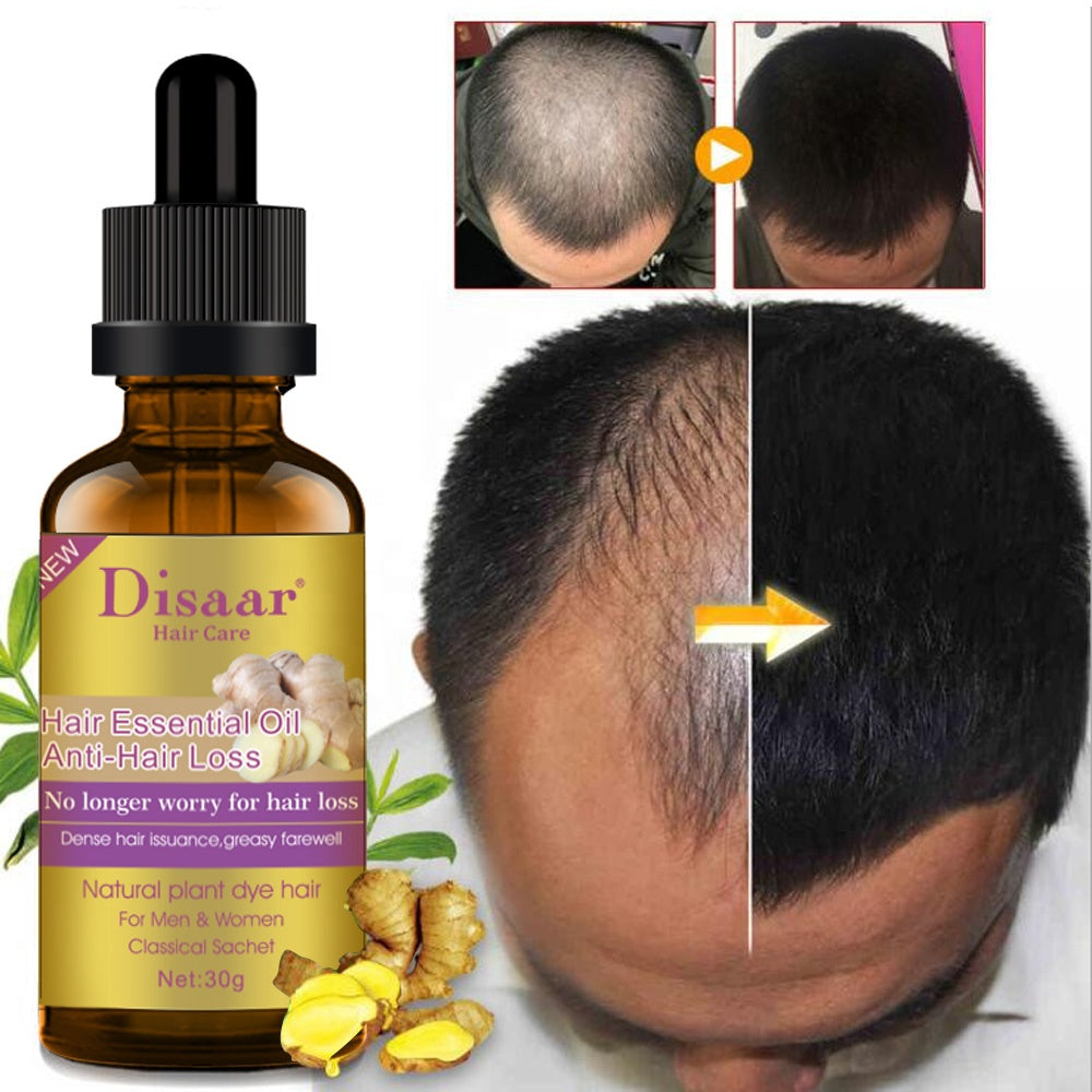 Ginger Hair Growth Oil